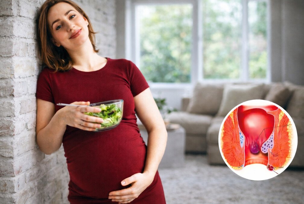 hemorrhoid medicine hemorrhoid medicine for pregnancy hemorrhoids pregnancy treatment healing hemorrhoids during pregnancy Piles pregnancy cure postpartum hemorrhoids